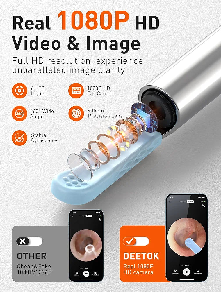 Smart Visual Ear Wax Cleaner