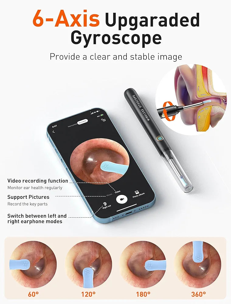 Smart Visual Ear Wax Cleaner